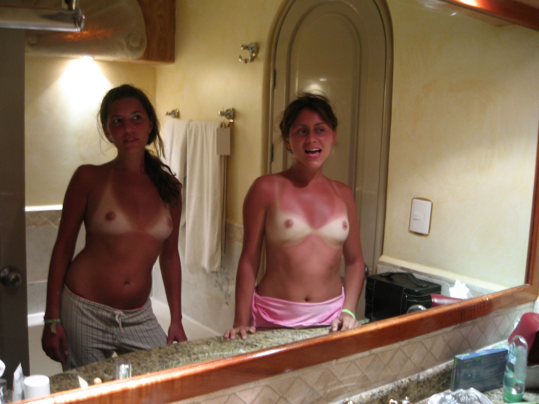 Sunburn (11).jpg